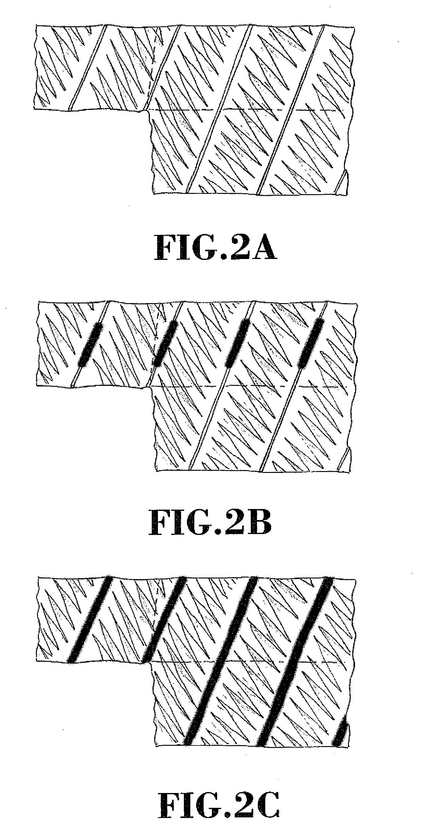 Method for obtaining gut with marks and a meat product with marks, gut and meat products thus obtained