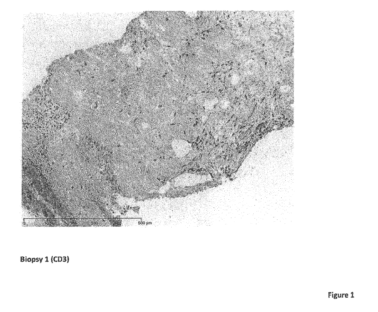 Cancer therapy with an oncolytic virus combined with a checkpoint inhibitor