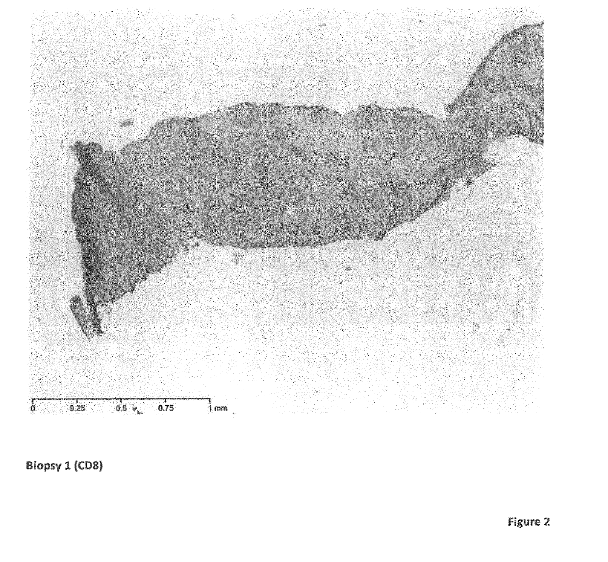 Cancer therapy with an oncolytic virus combined with a checkpoint inhibitor