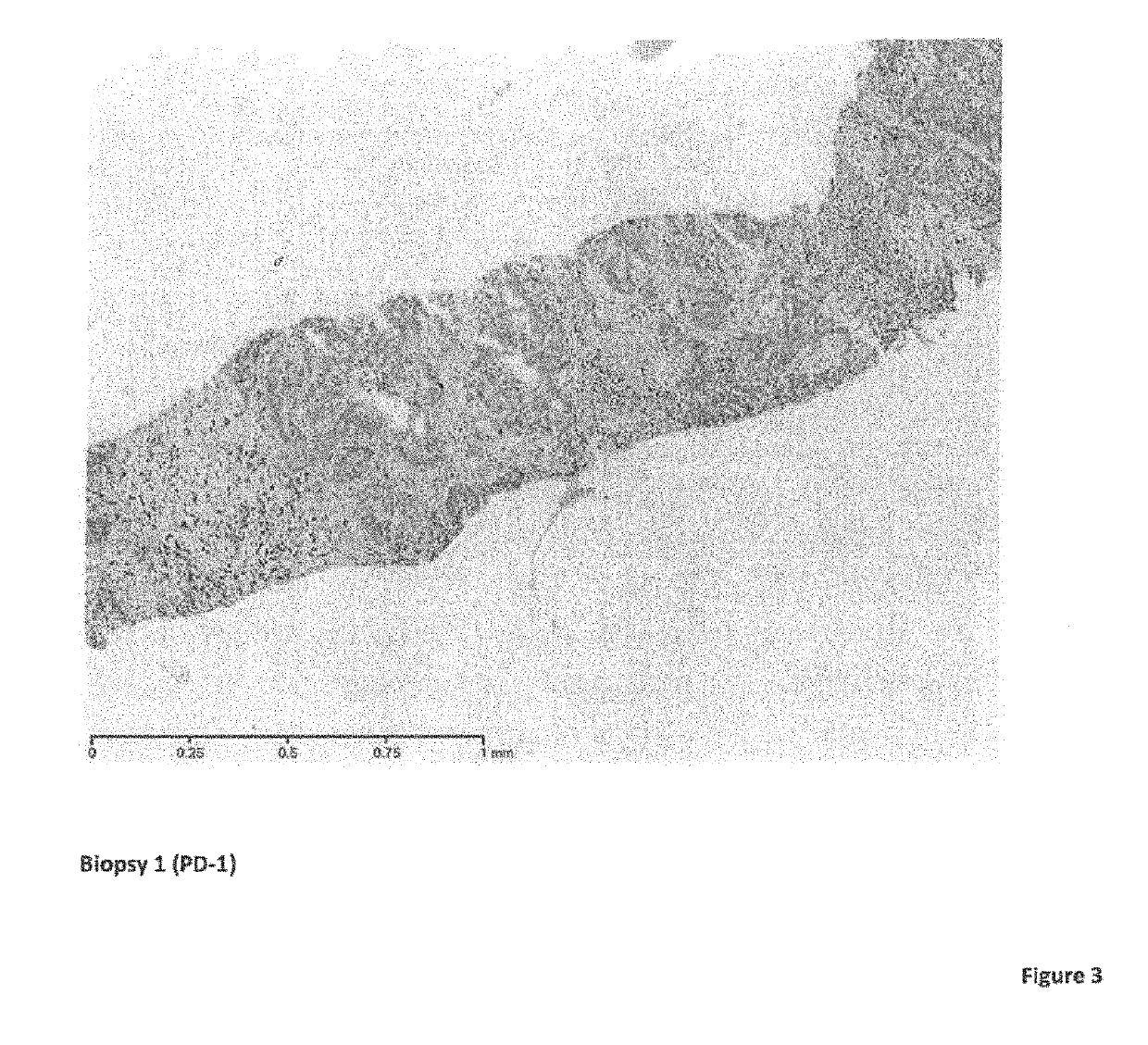 Cancer therapy with an oncolytic virus combined with a checkpoint inhibitor