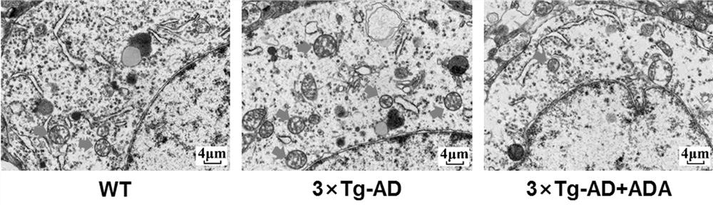 Application of triacetyl andrographolide as medicine for regulating degradation of autophagosome