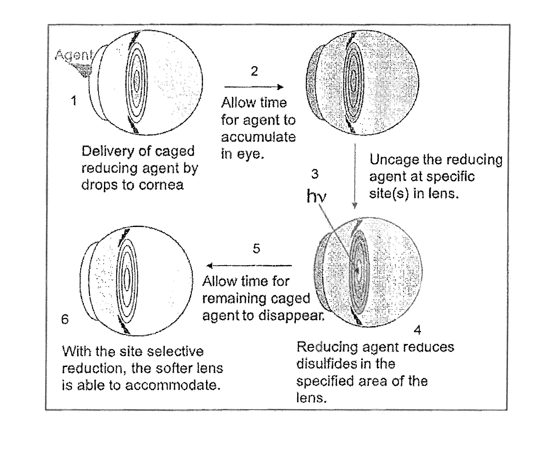 Dithiol compounds and treatment of presbyopia using said compounds