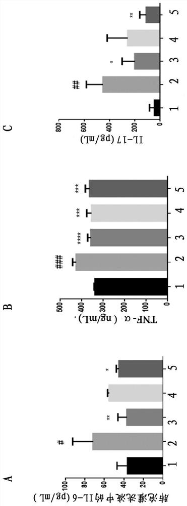 Application of thymosin beta4 in preparation of medicine for treating pulmonary fibrosis complicated with lung cancer disease