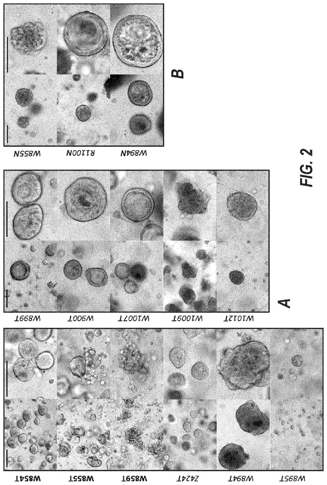 Culture medium for expanding breast epithelial stem cells