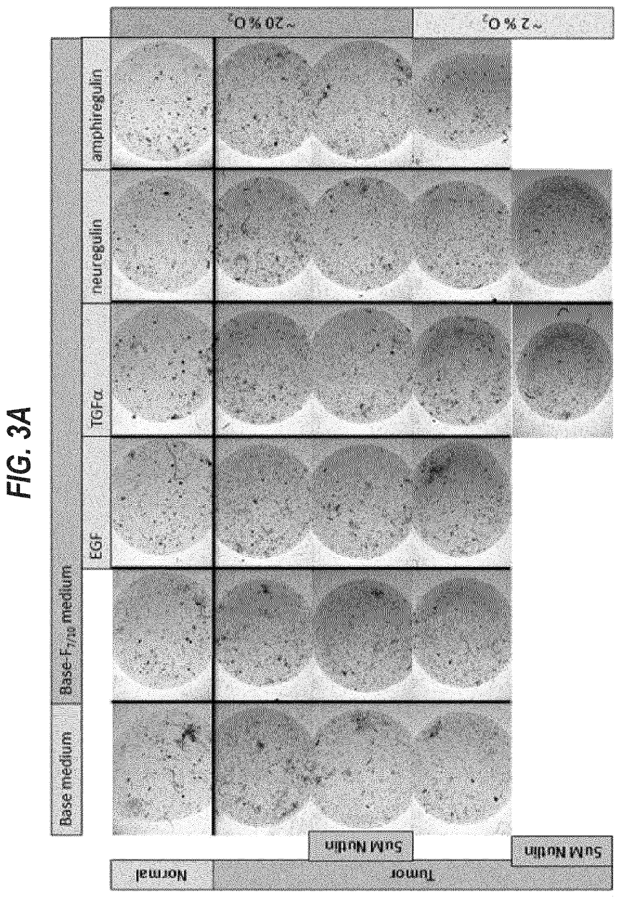 Culture medium for expanding breast epithelial stem cells