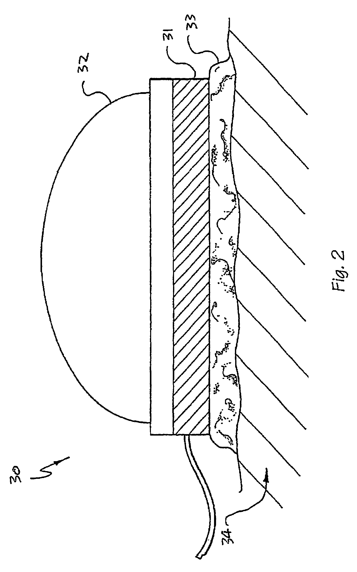 Blood flow oxygen measurement system and method