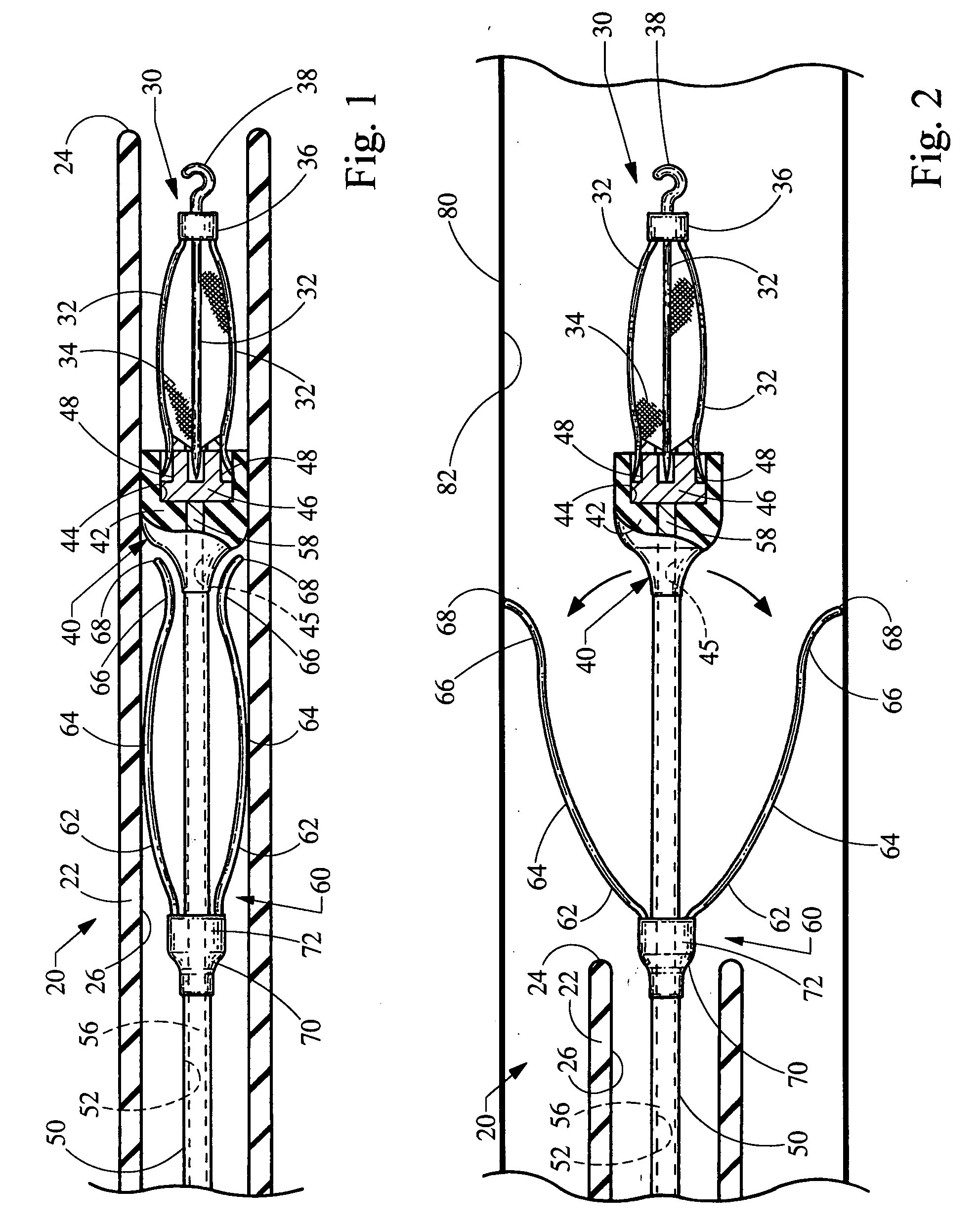 Self centering delivery catheter