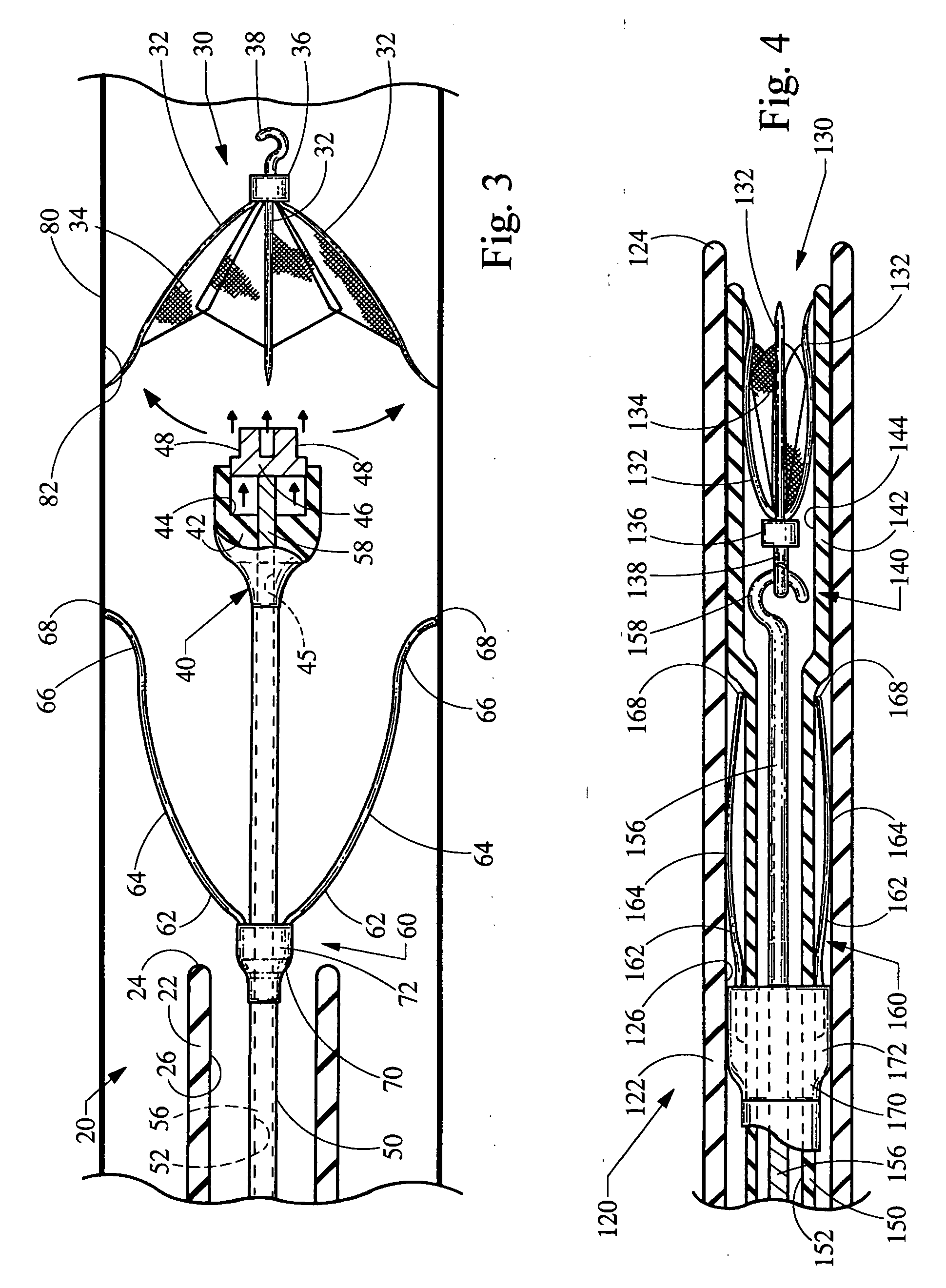 Self centering delivery catheter