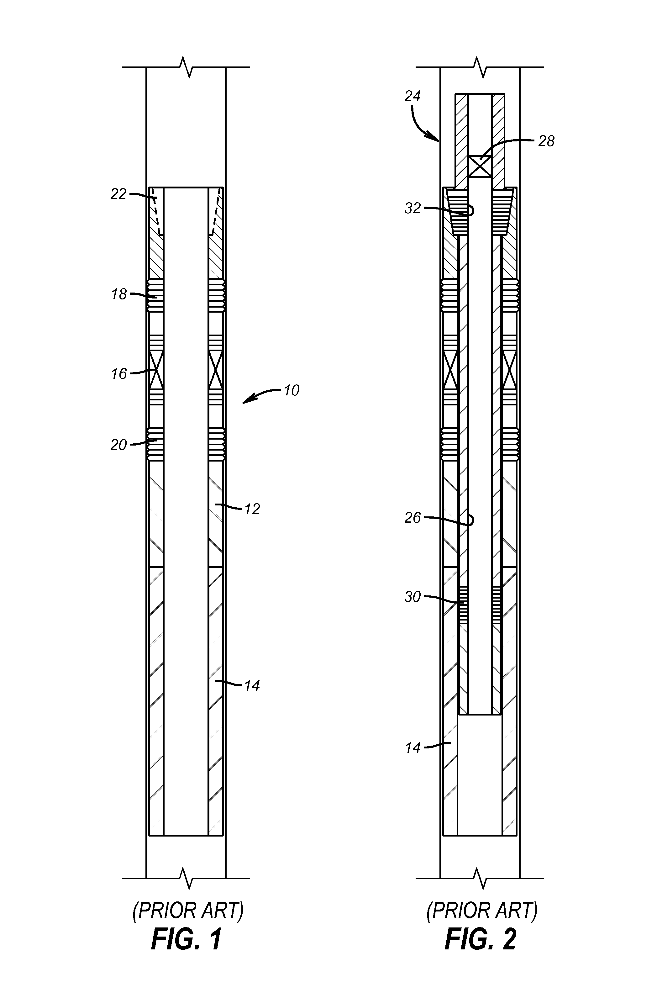 Removable packer plug with installation bypass feature