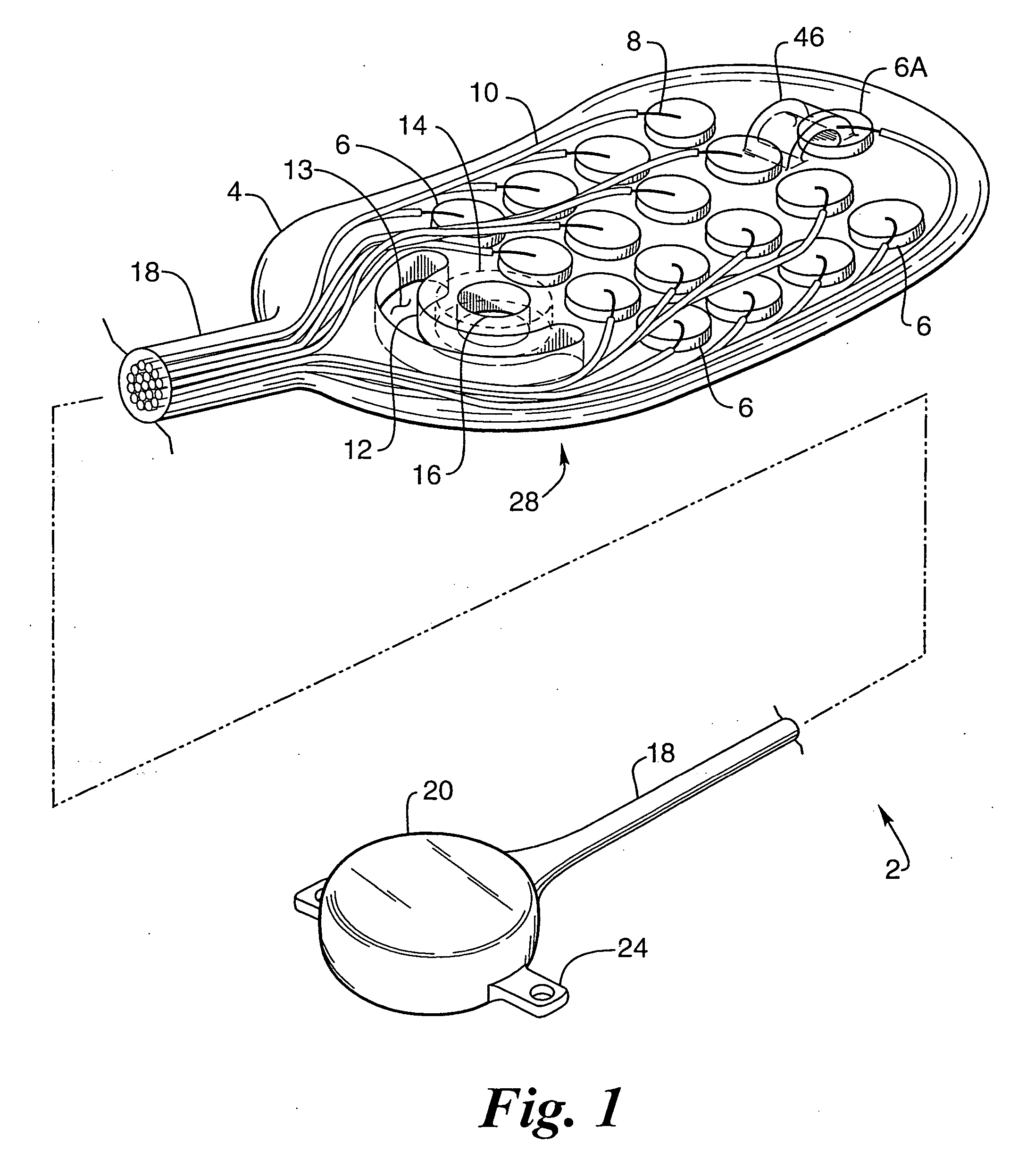 Implantable drug delivery device