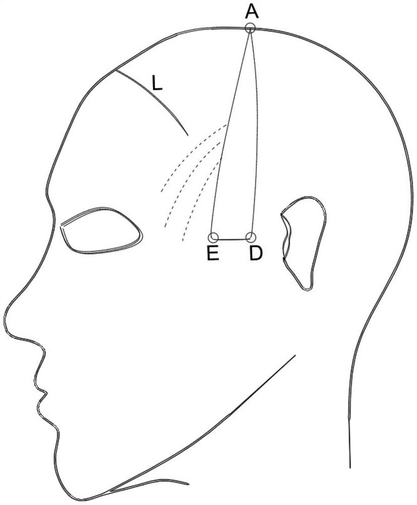 Head and face three-dimensional lifting method