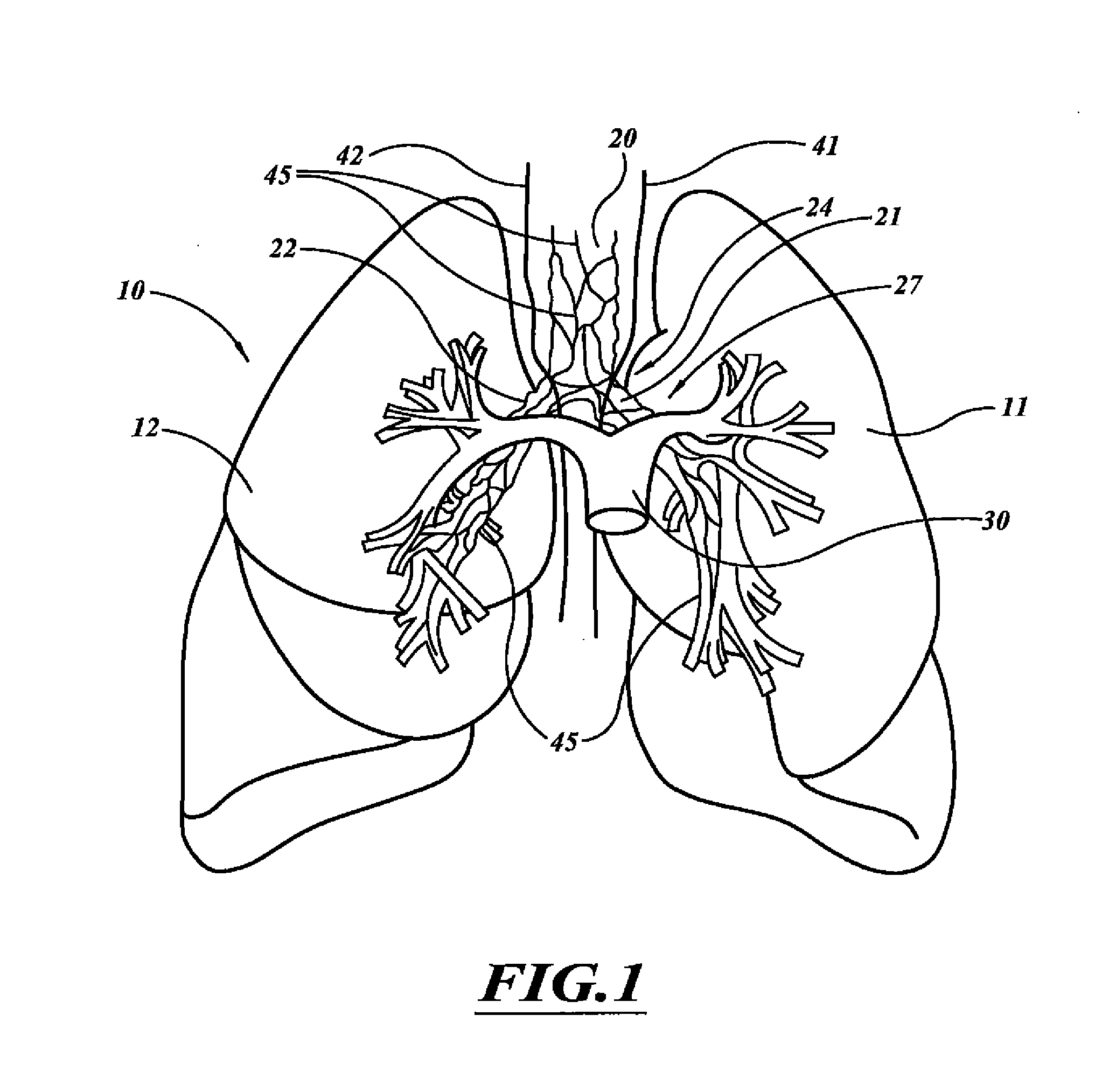 Systems, devices, and methods for treating a pulmonary disorder with an agent