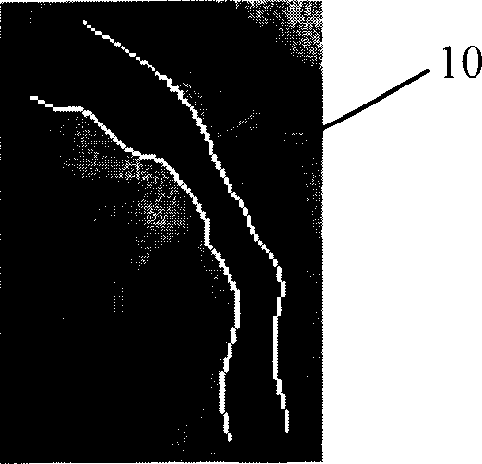 Method and system for positioning blood vessel support and selecting support before operation