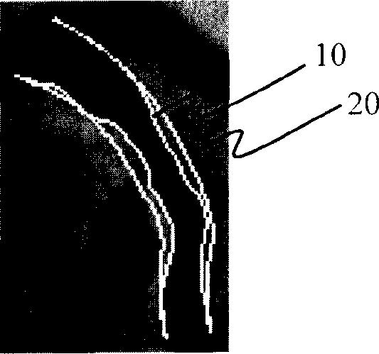 Method and system for positioning blood vessel support and selecting support before operation