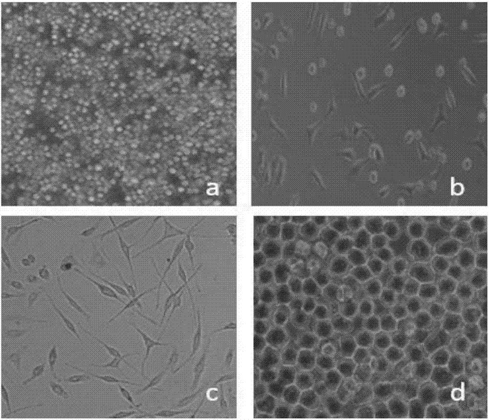 Colloidal gold test strip capable of simultaneously detecting type-1 and type-3 duck hepatitis A viruses and preparation method of colloidal gold test strip