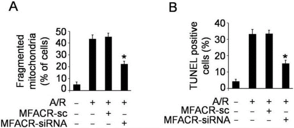 Pharmaceutical composition of targeting circRNA (circular Ribonucleic Acid) and application of pharmaceutical composition