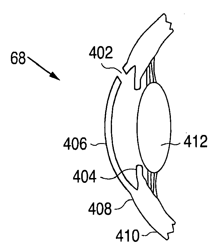 Method and apparatus for creating ocular surgical and relaxing incisions