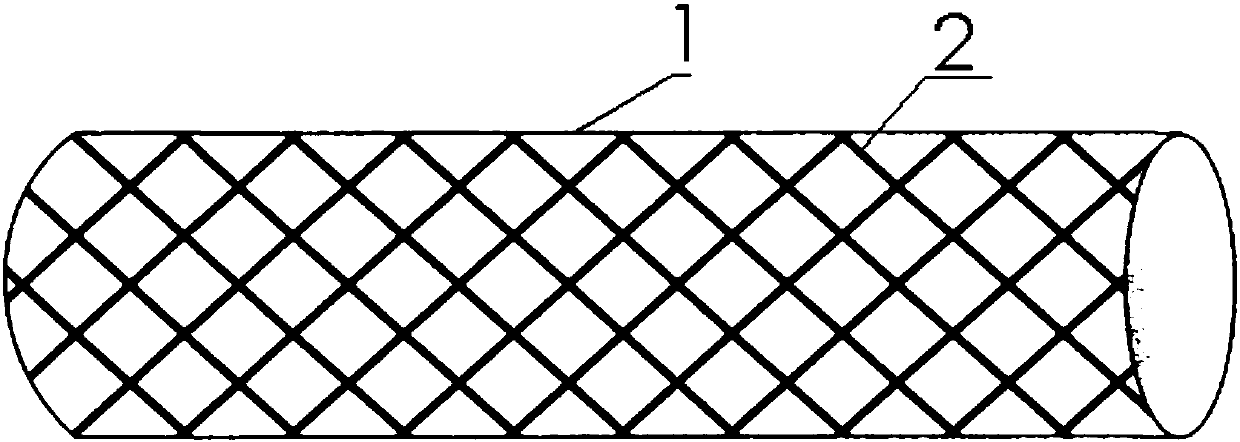 Recyclable heart stent