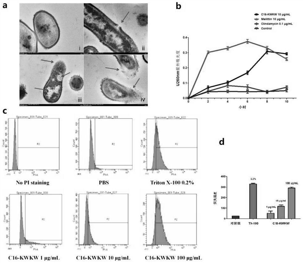 A short lipopeptide with specific anti-Propionibacterium acnes and anti-inflammatory effects