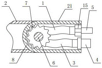 Hypophysoma cutting and removing device