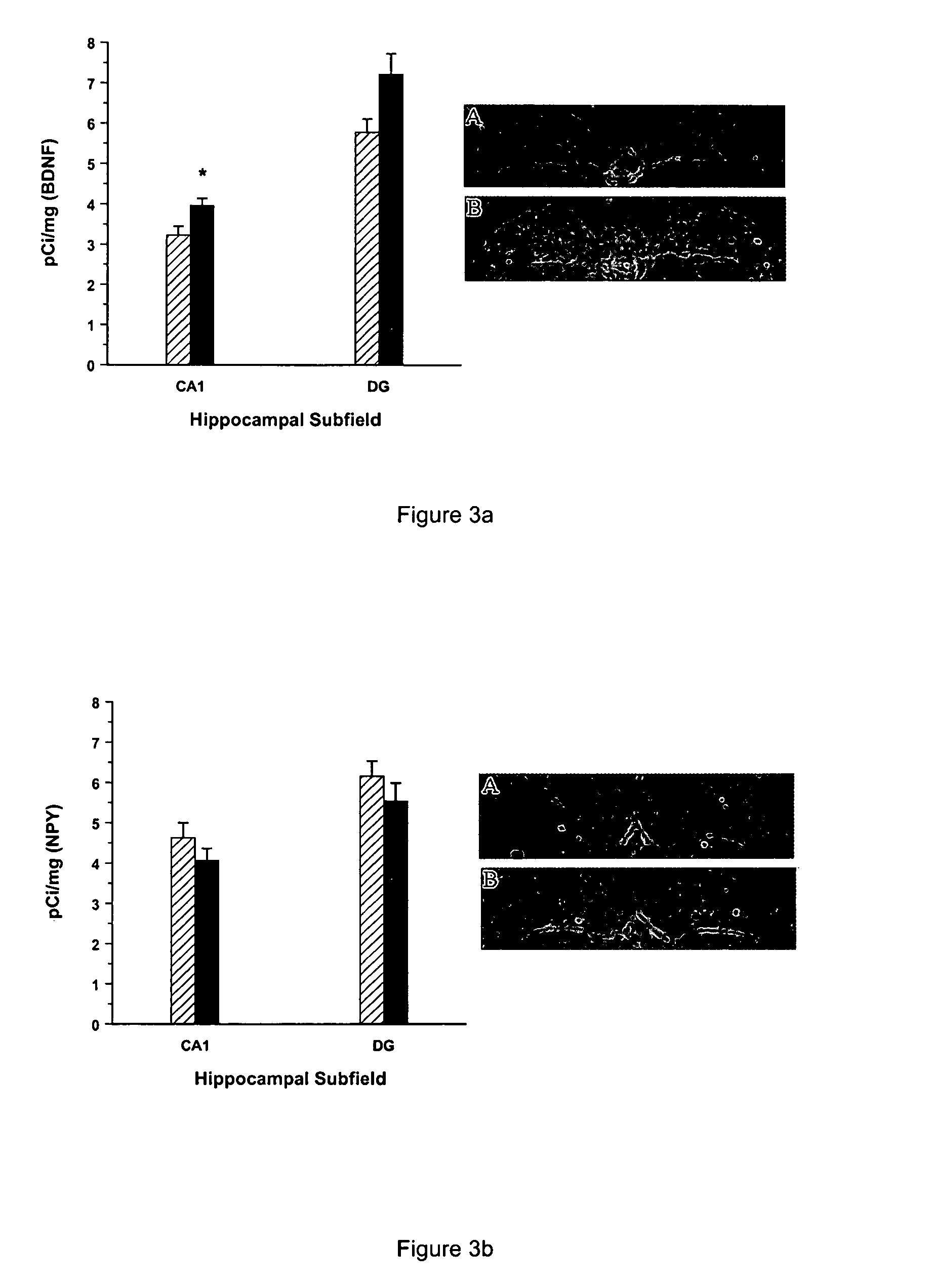 Developmental animal model of temporal lobe epilepsy