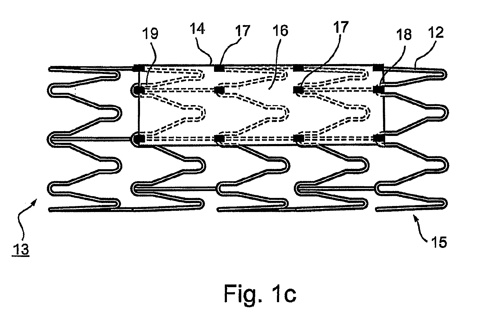 Implantable graft assembly and aneurysm treatment