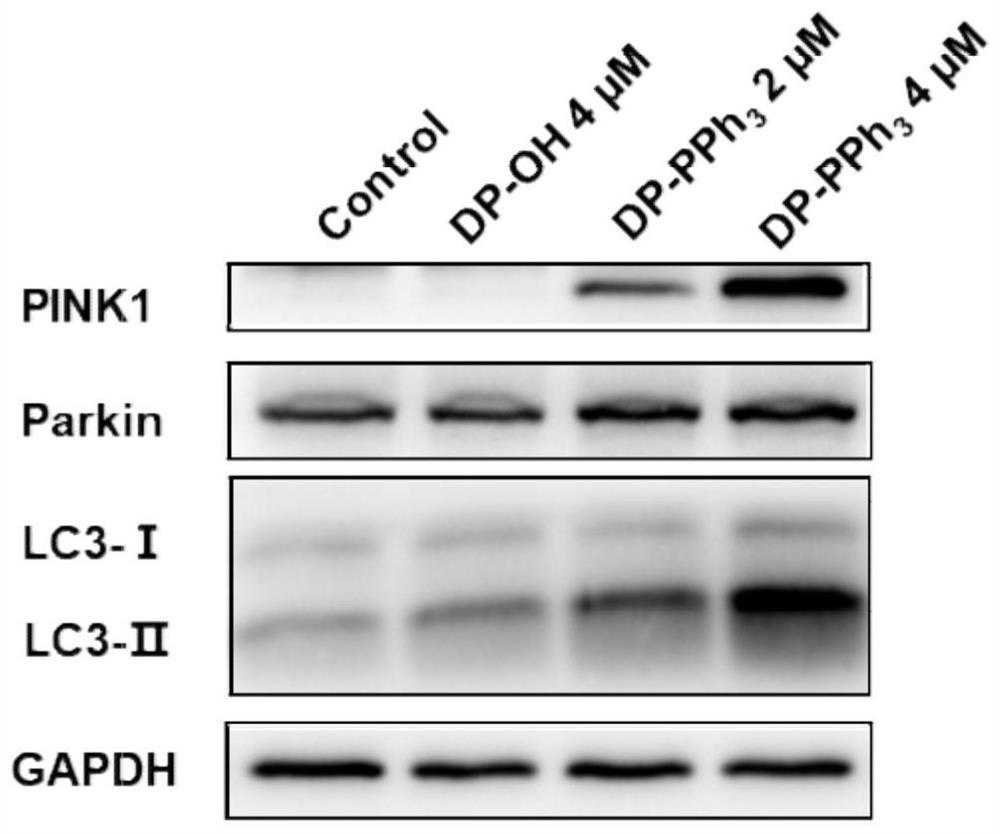 Mitochondrial targeting compound with aggregation-induced emission property and synthesis method and application thereof