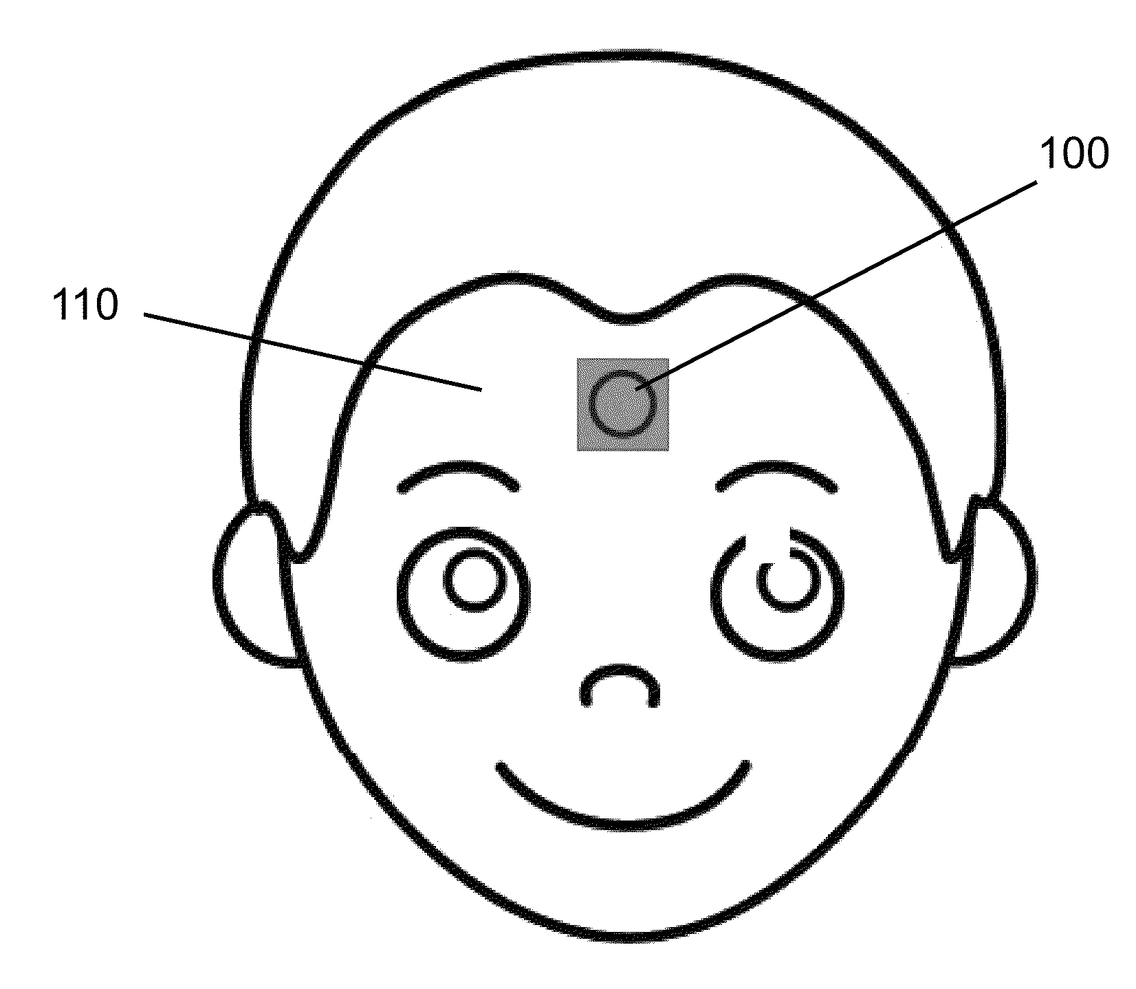 Stretchable electronic patch having a foldable circuit layer