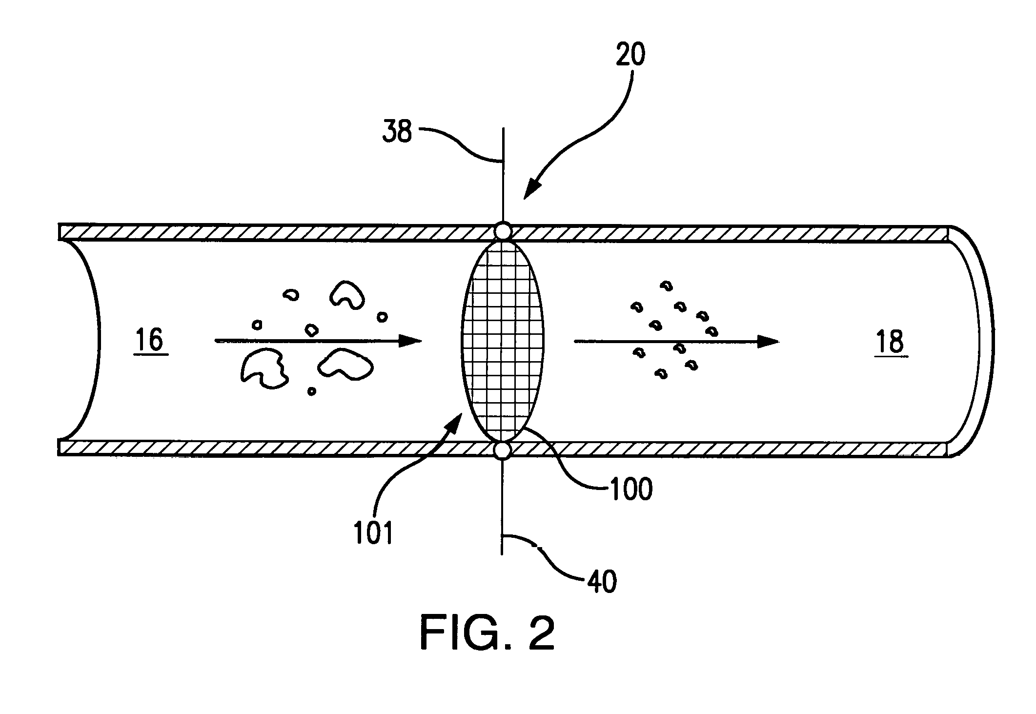 Electrically heated filter screens