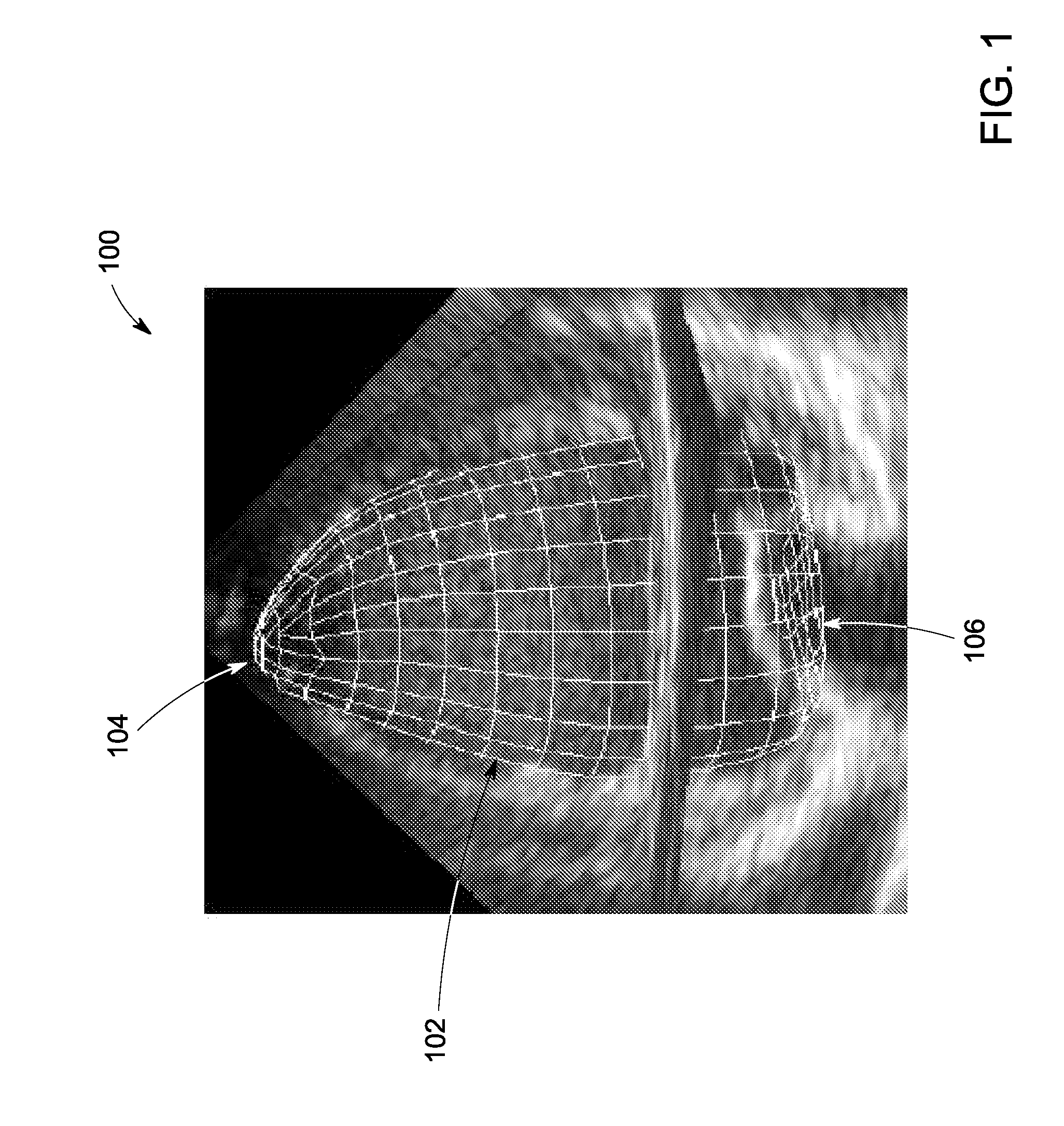 Method for Calculating The Sphericity of a Structure