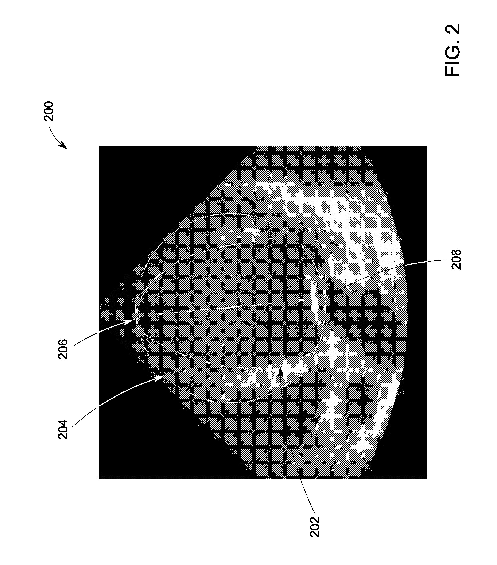 Method for Calculating The Sphericity of a Structure