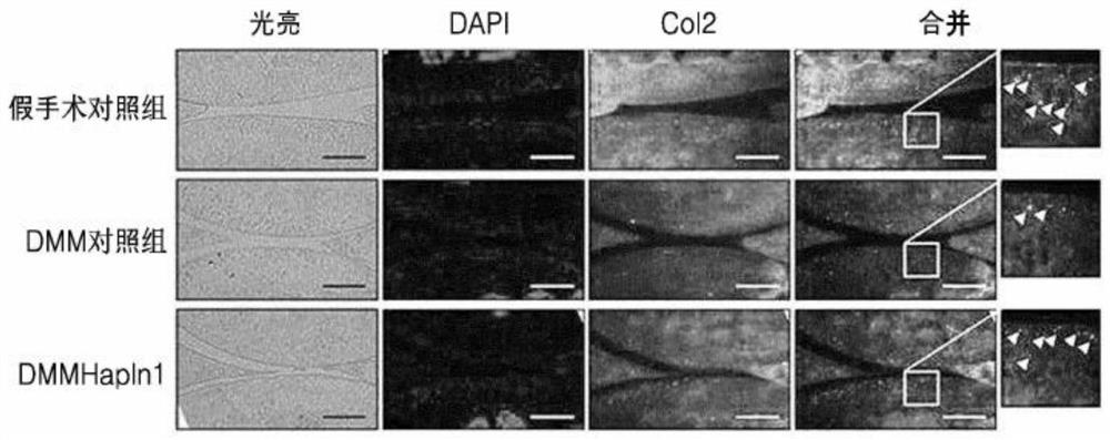 Composition, for preventing, relieving or treating cartilage-related diseases or symptoms, comprising hapln1