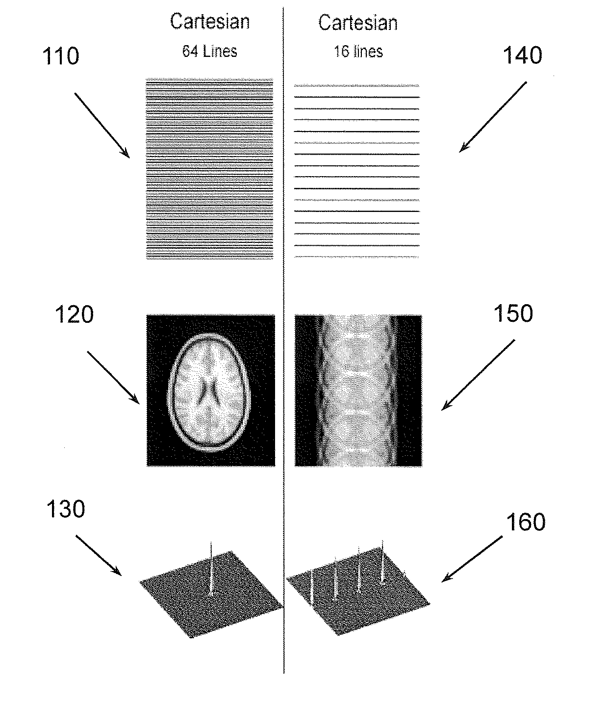 Non-cartesian under-sampled multi-echo MRI