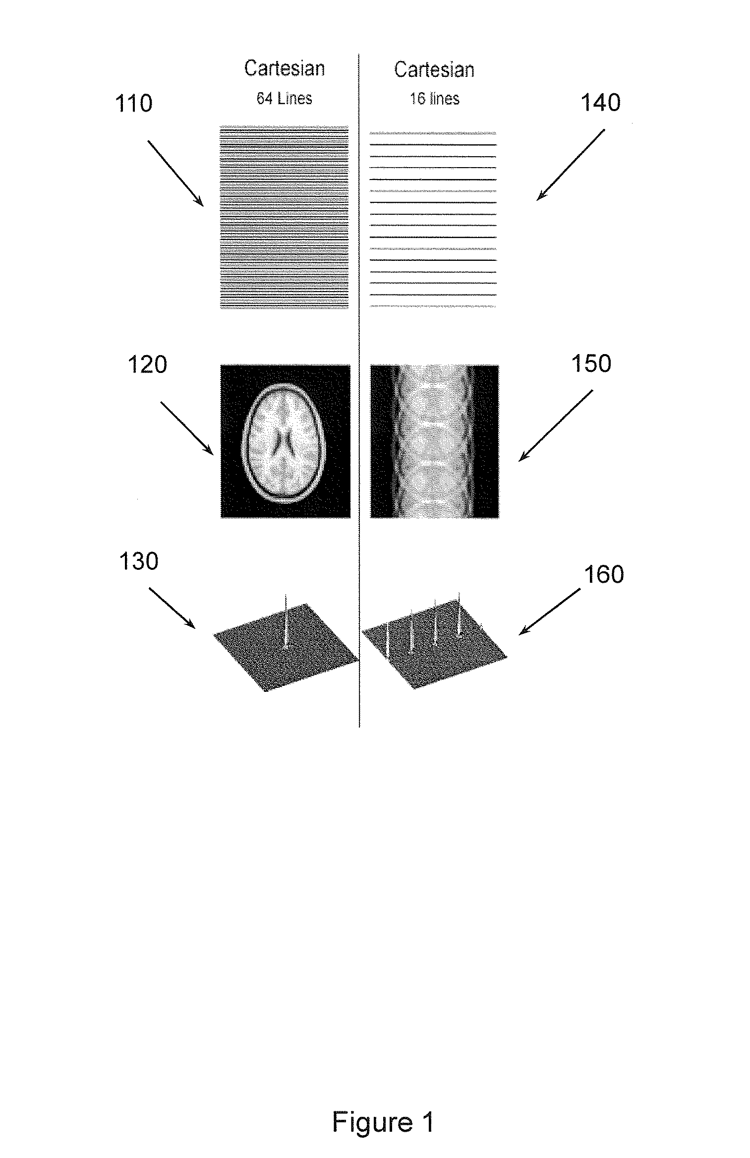 Non-cartesian under-sampled multi-echo MRI