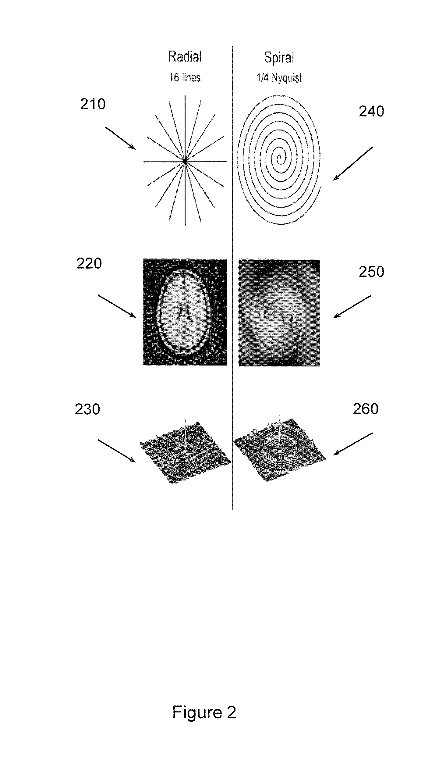 Non-cartesian under-sampled multi-echo MRI