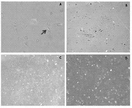 Primary culture method for porcine liver cells