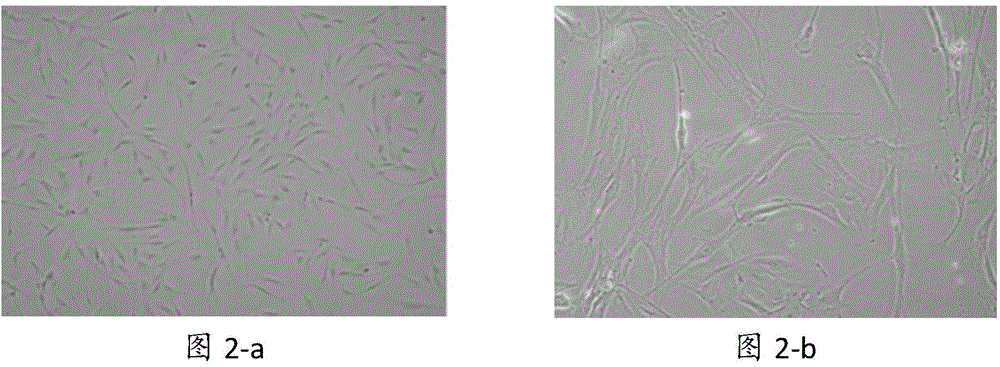 Leukocyte extract and preparation method and application thereof