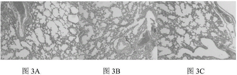 Traditional Chinese medicine compound prescription for simultaneously resisting swine infuenza and porcine reproductive and respiratory syndrome and extraction method thereof