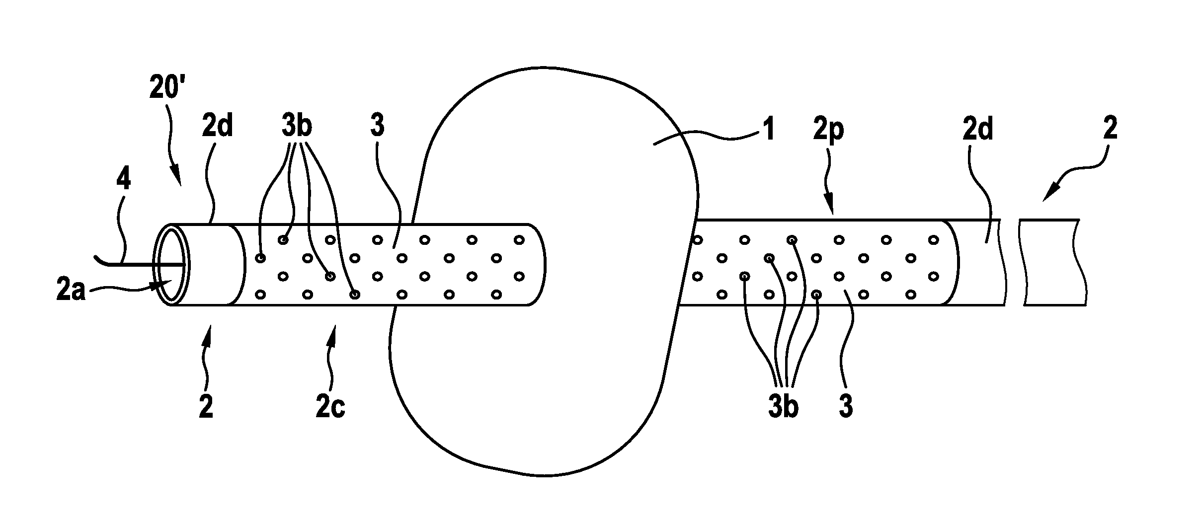 Open-pore balloon catheter