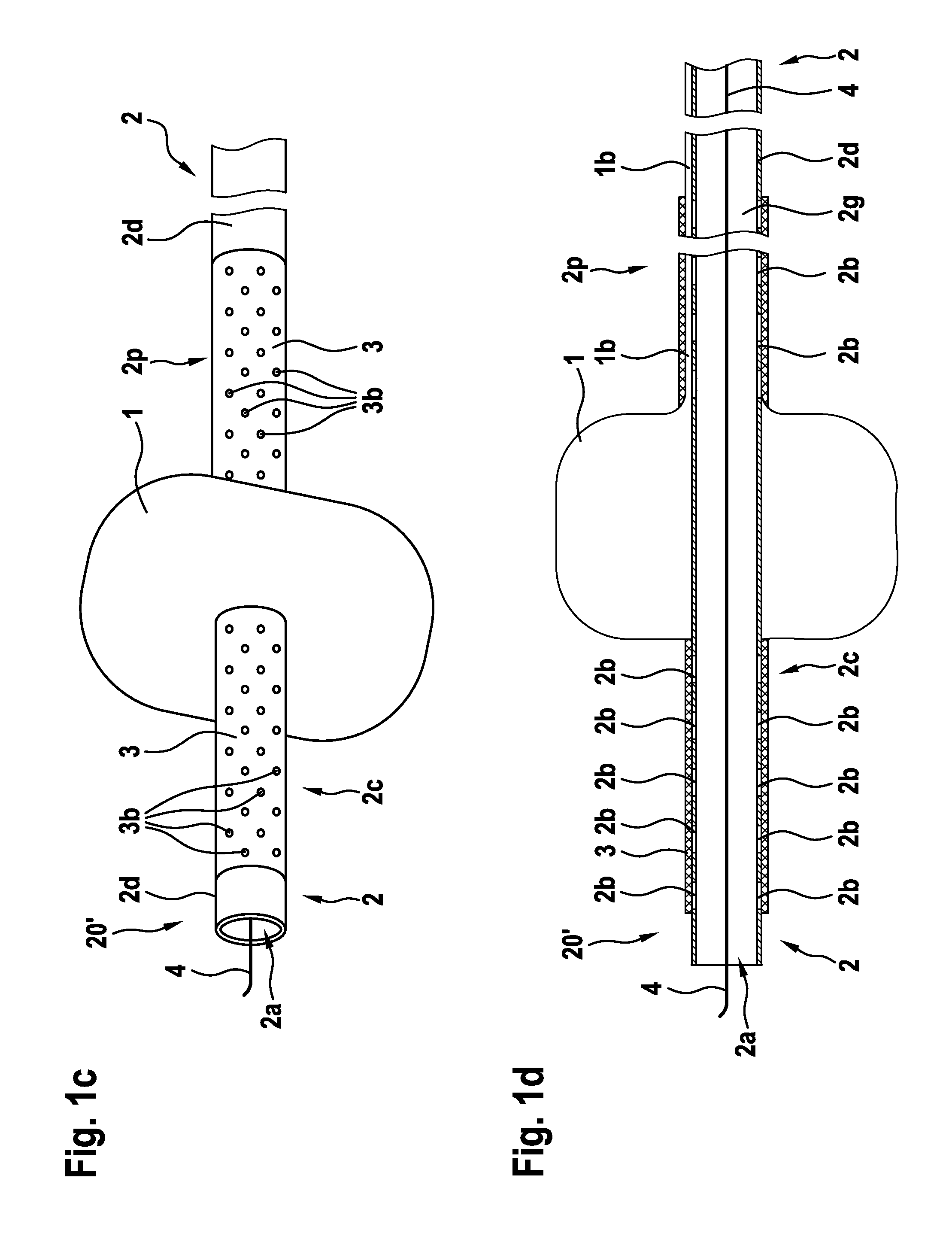 Open-pore balloon catheter