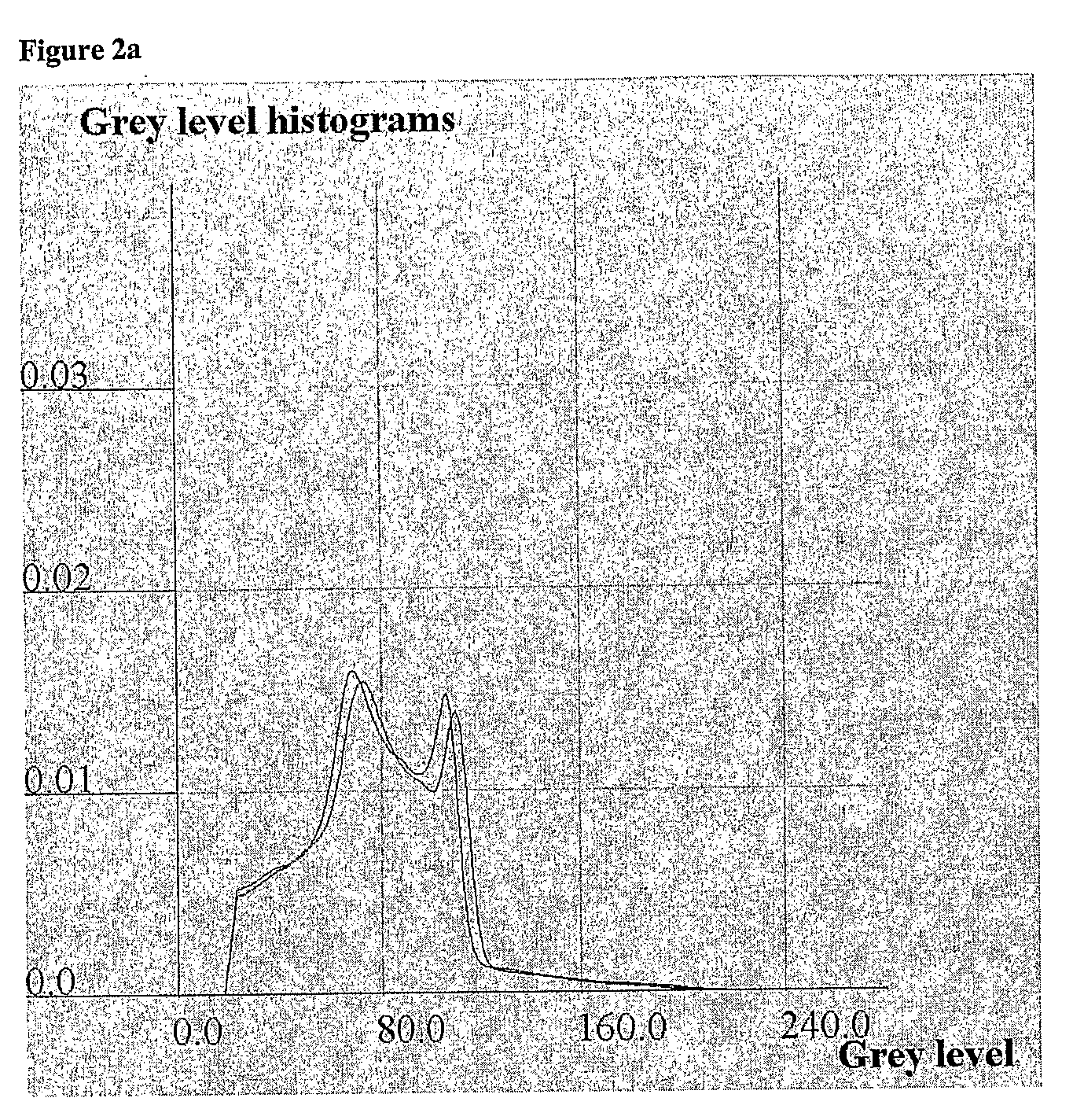 Method and apparatus for determining asymmetry in an image