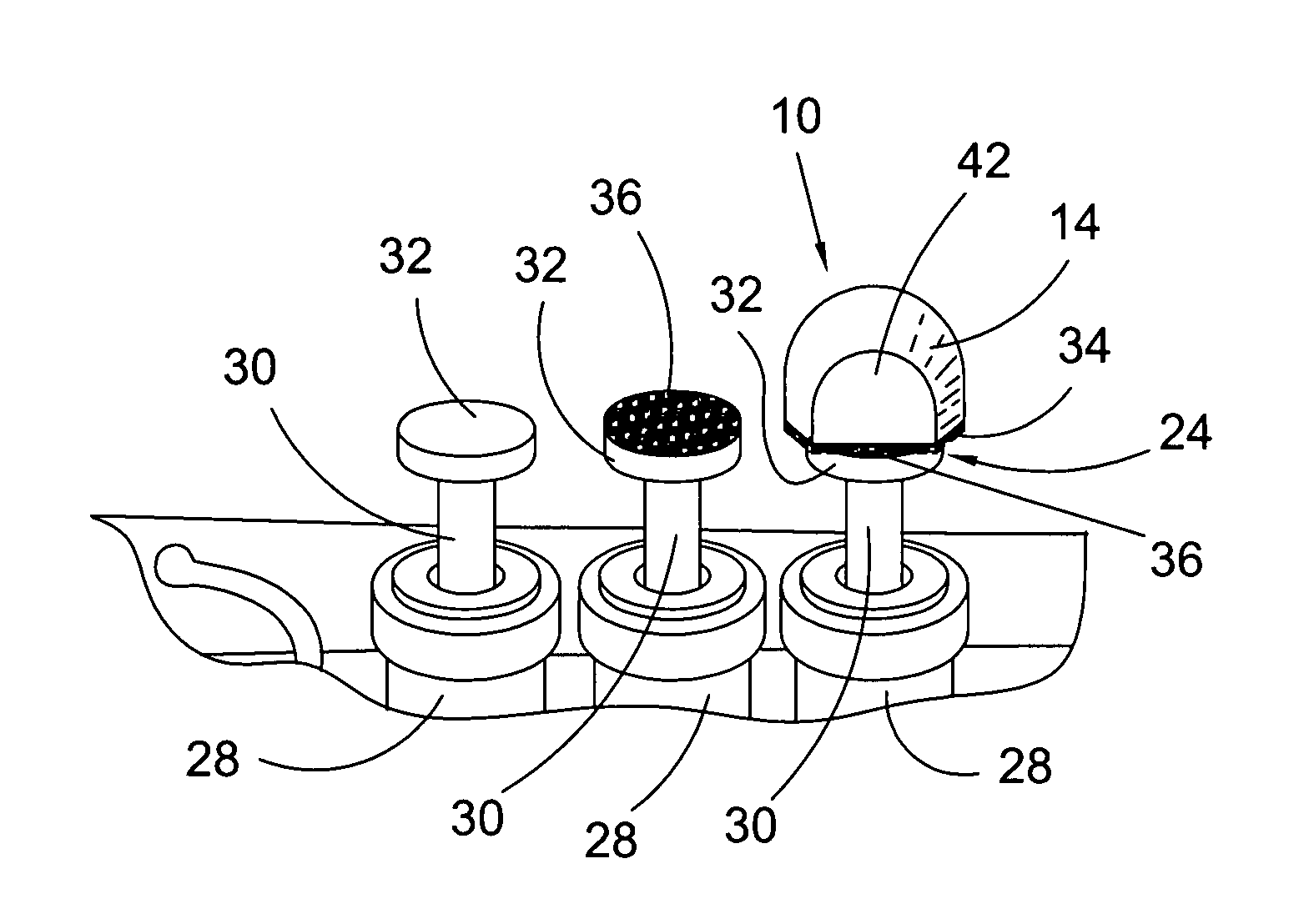 Finger alignment training device