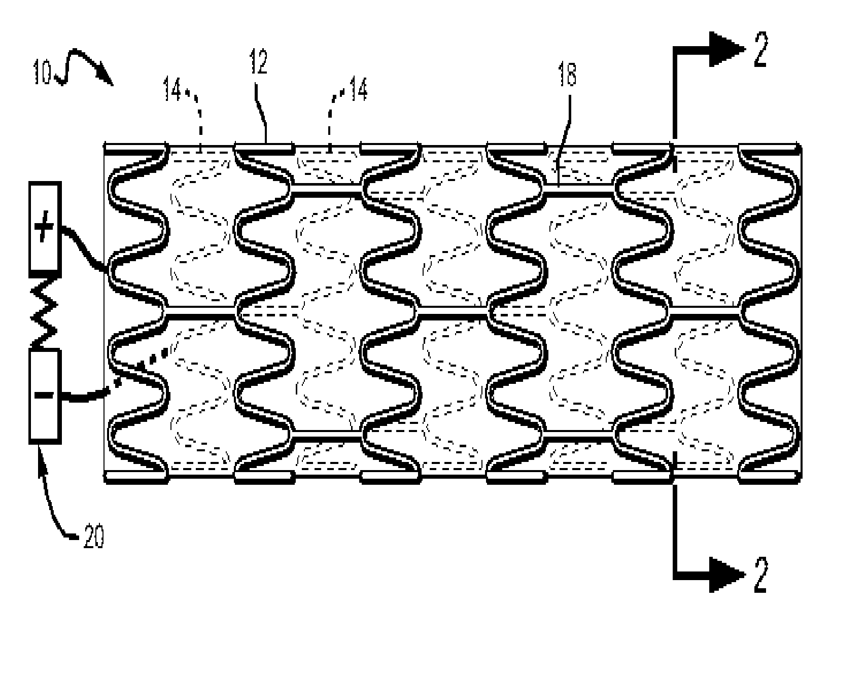 Electronic Anti-coagulation stent for intra-arterial deployment