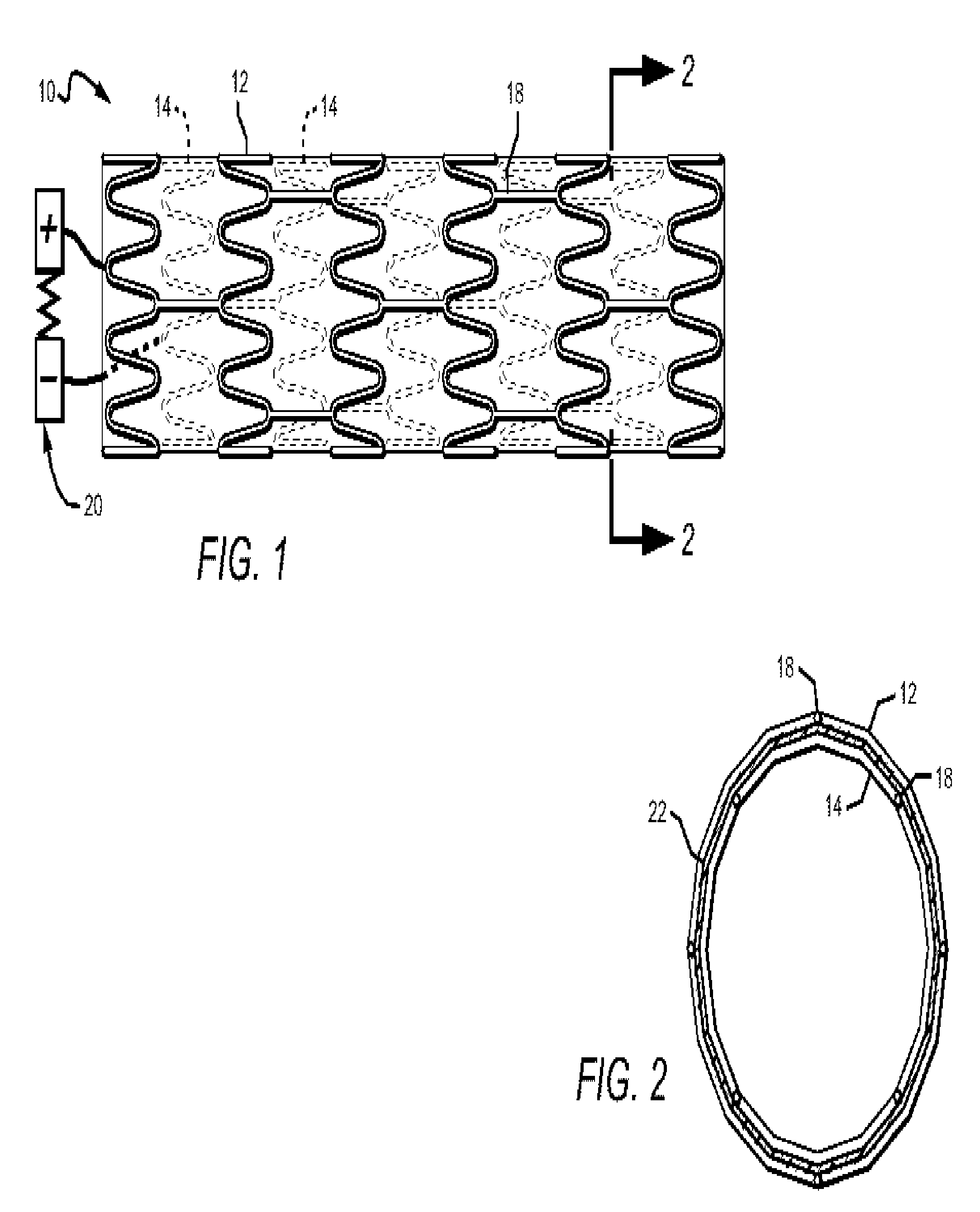 Electronic Anti-coagulation stent for intra-arterial deployment