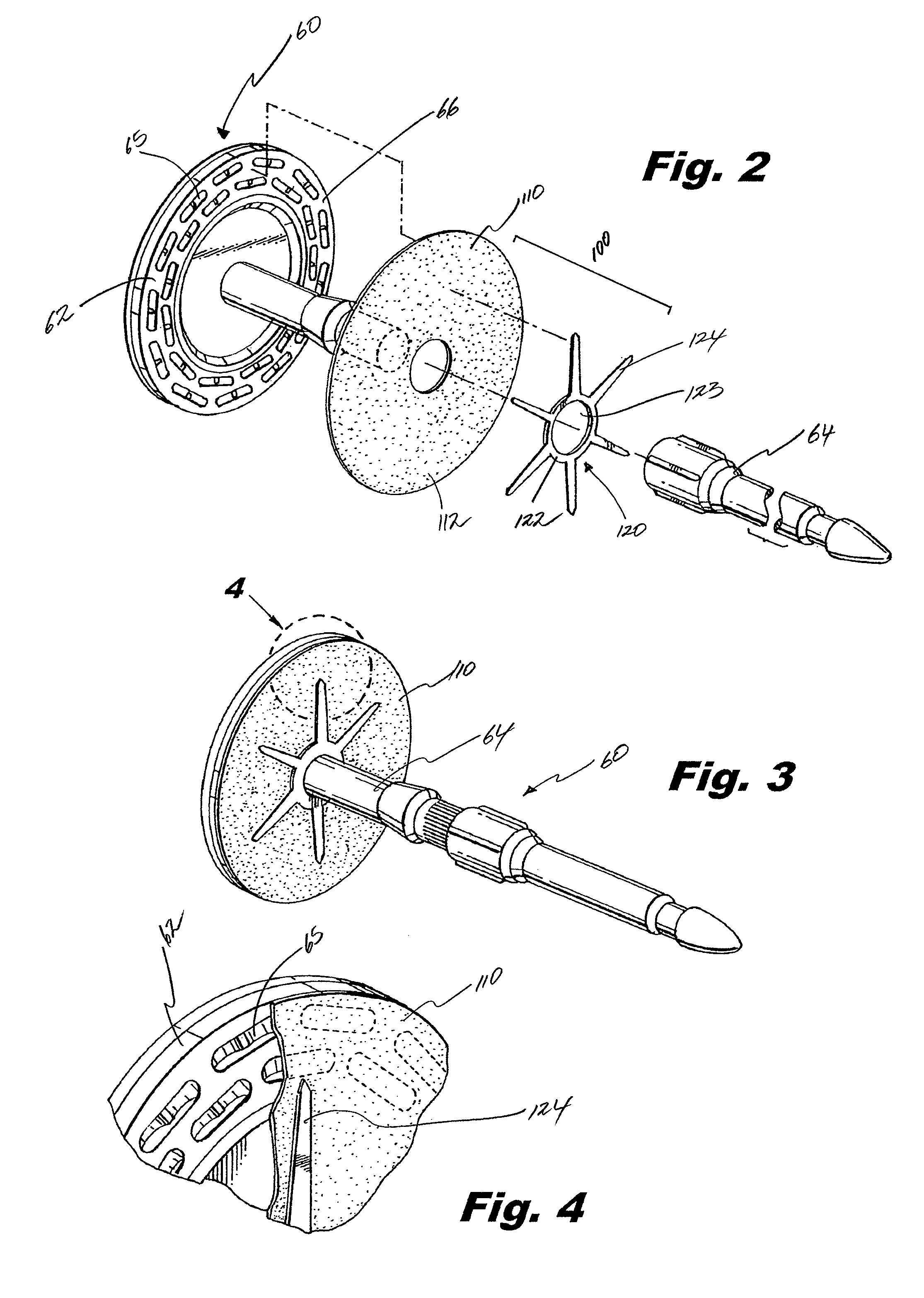 Buttress support design for EEA anvil