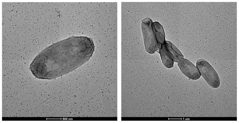 Strain capable of degrading collagen and application of strain