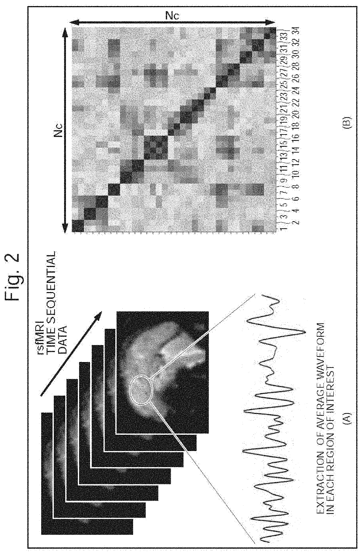 Brain functional connectivity correlation value adjustment method, brain functional connectivity correlation value adjustment system, brain activity classifier harmonization method, brain activity classifier harmonization system, and brain activity biomarker system