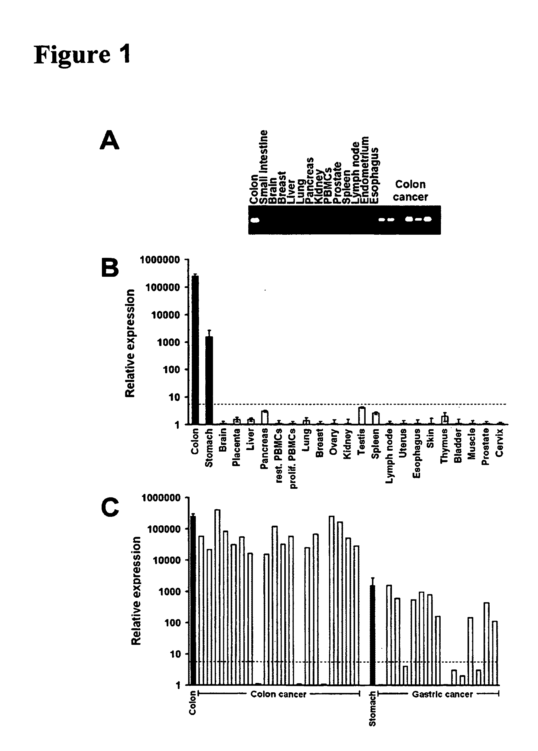 Methods and compositions for diagnosis and treatment of cancer