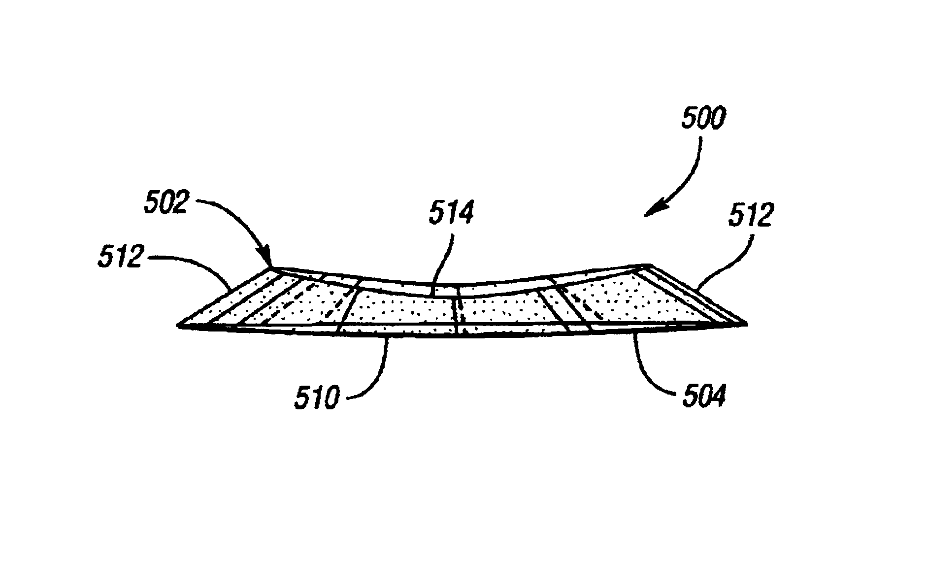 Surgically implantable knee prosthesis having different tibial and femoral surface profiles