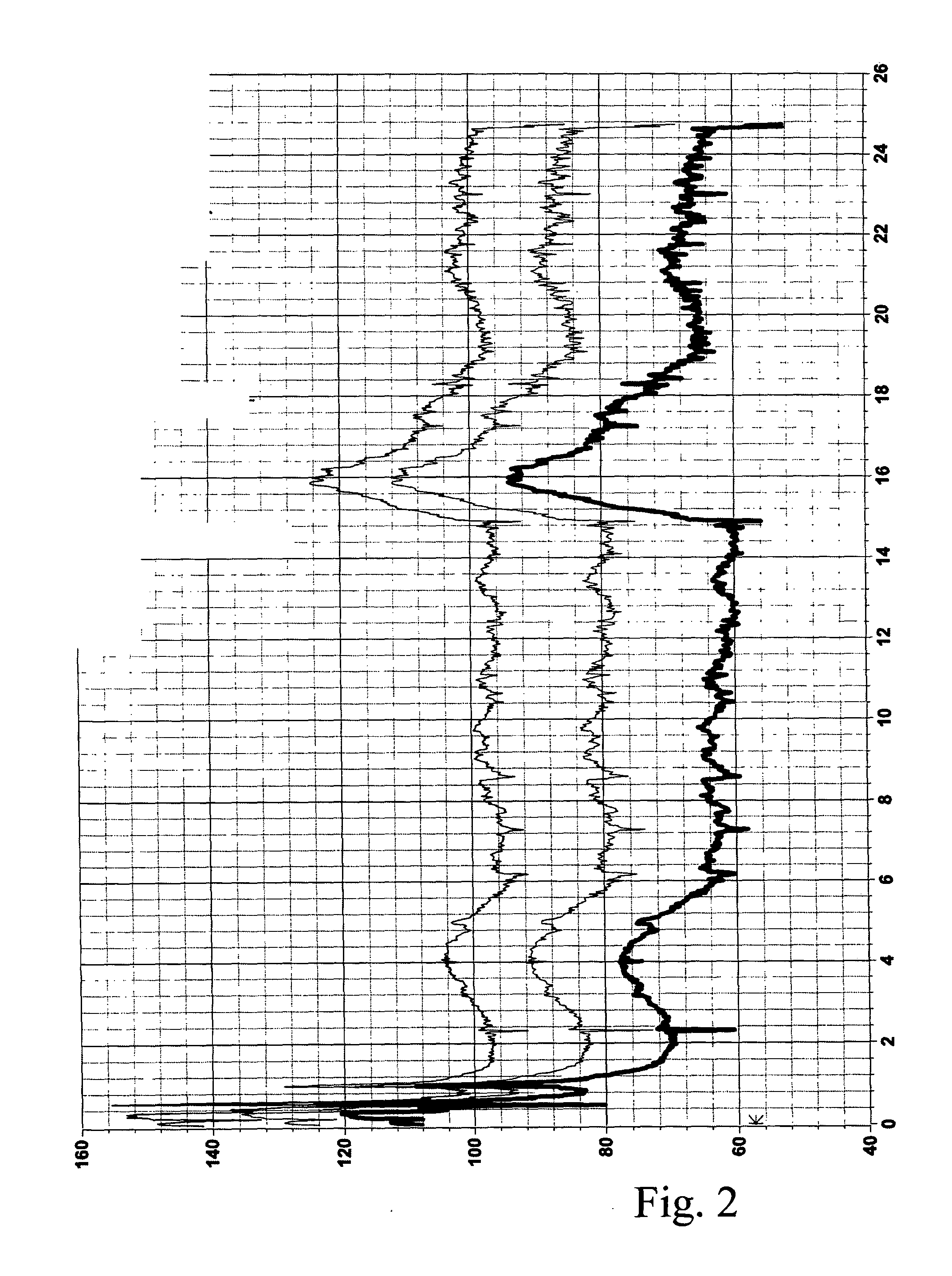 Composition comprising nor-adrenaline and amphetamine for administering to a brain-dead, heart-beating potential organ donor